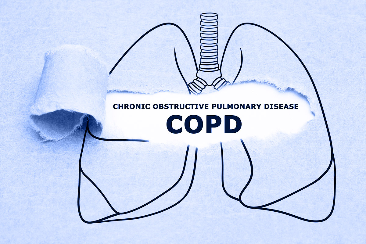 COPD